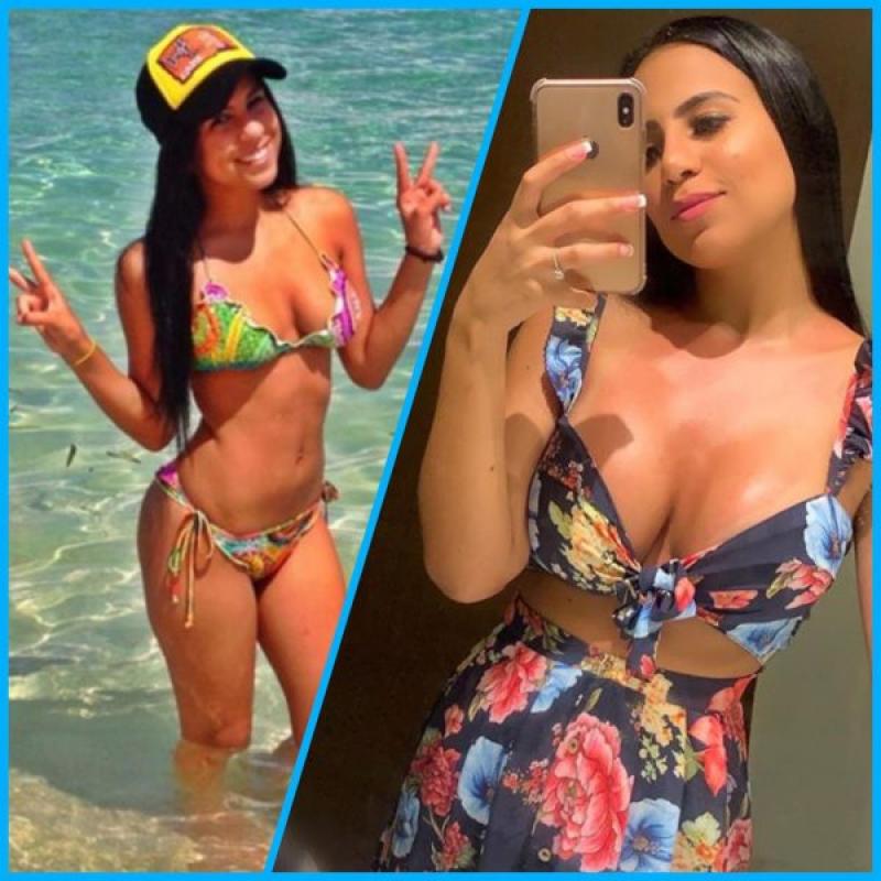 Lily Díaz: Antes Y Después De Sus Cirugías